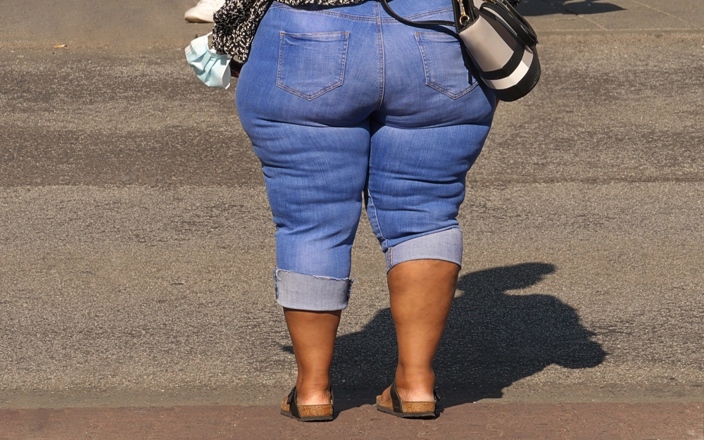 Ожирением называют состояние, при котором под кожей человека находится чрезмерное количество жировой ткани Ожирение