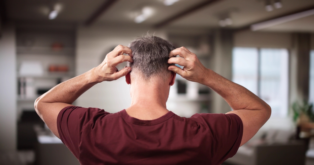 От проблемы «снега» на волосах и одежде страдает примерно треть населения планеты Причины появления перхоти у мужчин