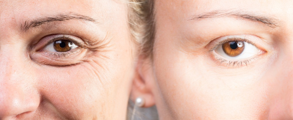 Вода с лимоном для молодости кожи Вода с лимоном для молодости кожи