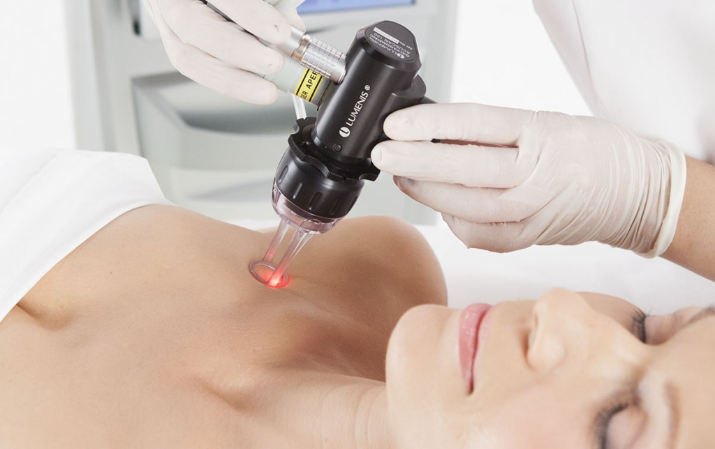 Лазерное удаление растяжек - самая радикальная и экстренная процедура Лазерное удаление растяже