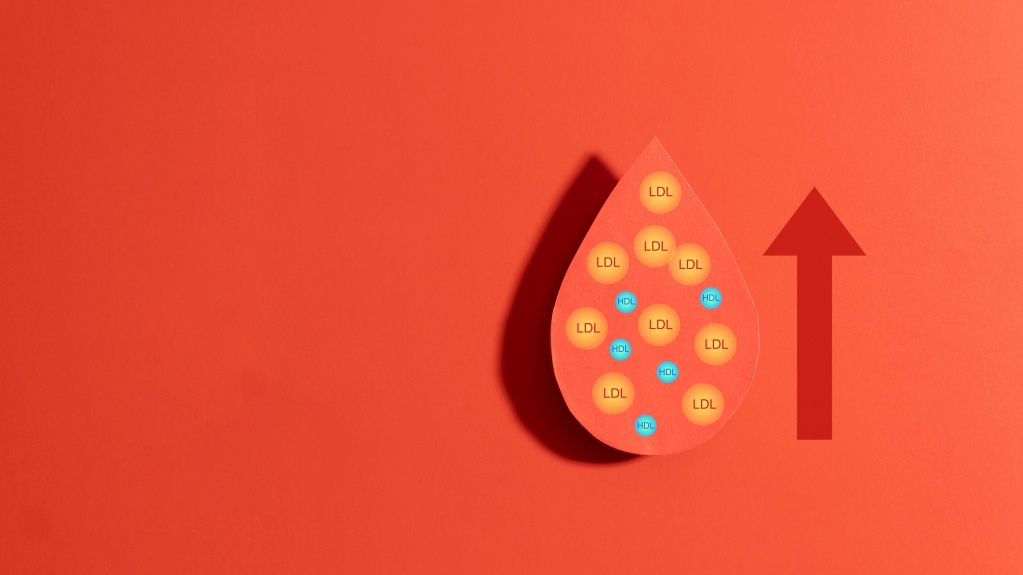 После 50 лет собственный рацион стоит выстраивать на основе правильного питания Что нужно есть при повышенном холестерине?