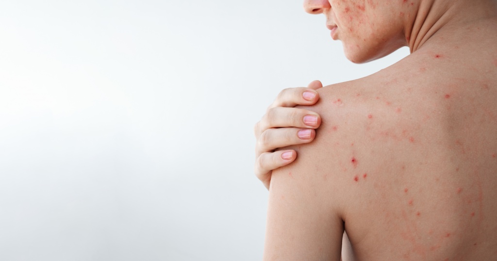 Женщины часто используют ванны с настоем подорожника ваннa с настоем подорожника