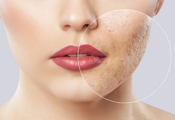 Использовать вещество стоит по многим причинам Преимущества липогидроксикислоты