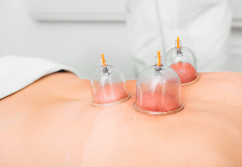 Баночный массаж можно проводить на любой части туловища – руки, ноги, ягодицы, живот Техника проведения антицеллюлитного массажа