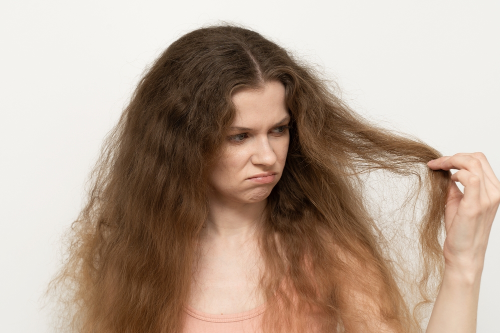 Дефицит микроэлемента можно распознать по неудовлетворительному состоянию волос Дефицит микроэлемента