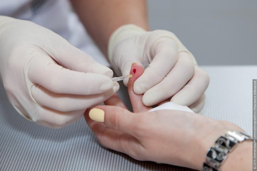 Анализ крови на СОЭ забирается очень быстро, для этого достаточно нескольких минут анализ крови на СОЭ