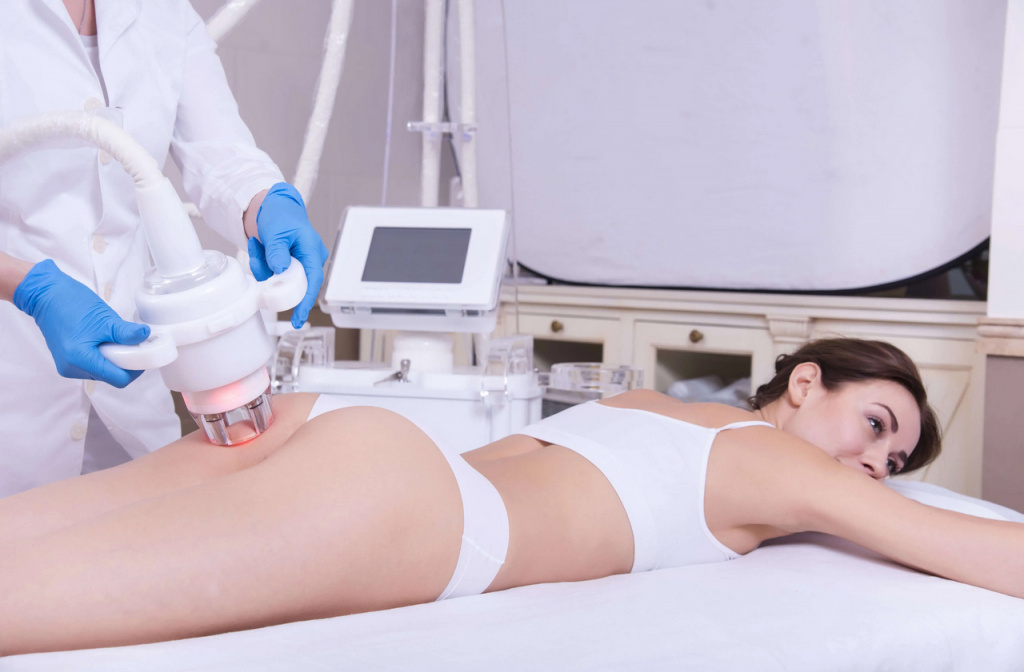 Устранение стрий лазером лечение лазером