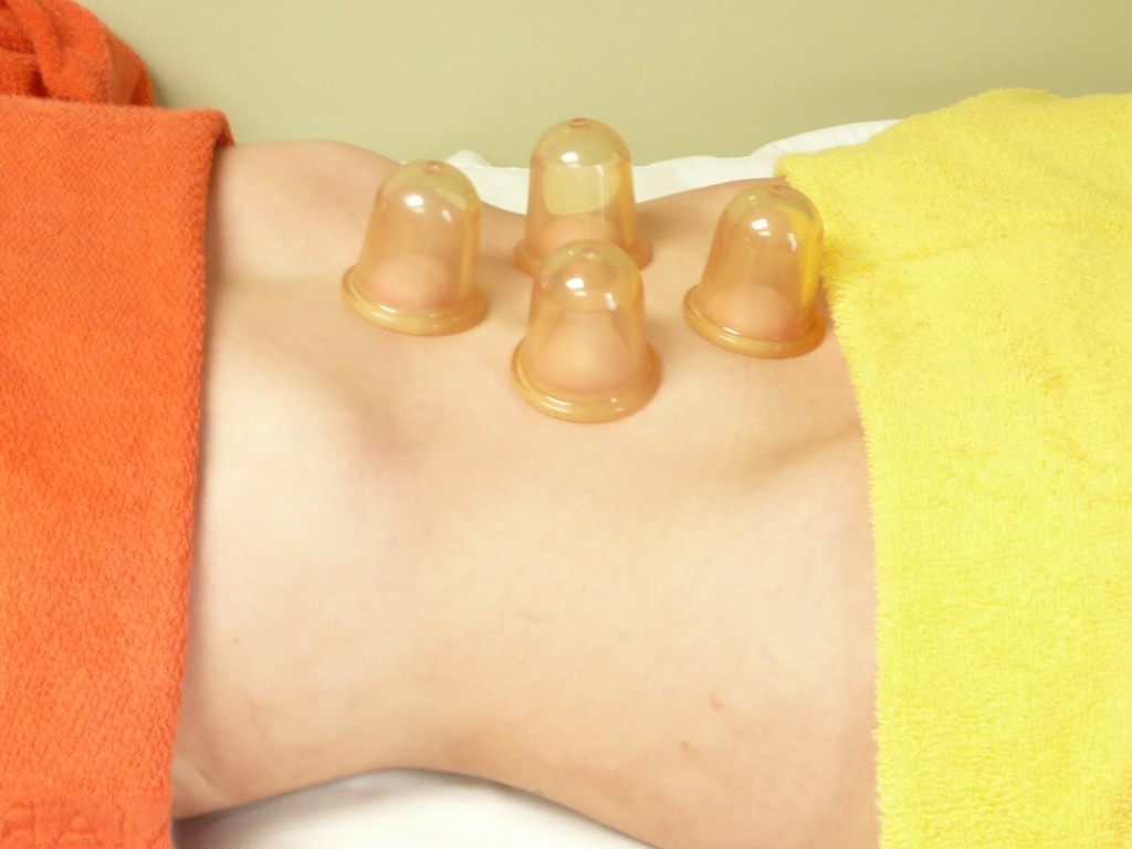 Баночный массаж можно проводить на любой части туловища – руки, ноги, ягодицы, живот Техника проведения антицеллюлитного массажа