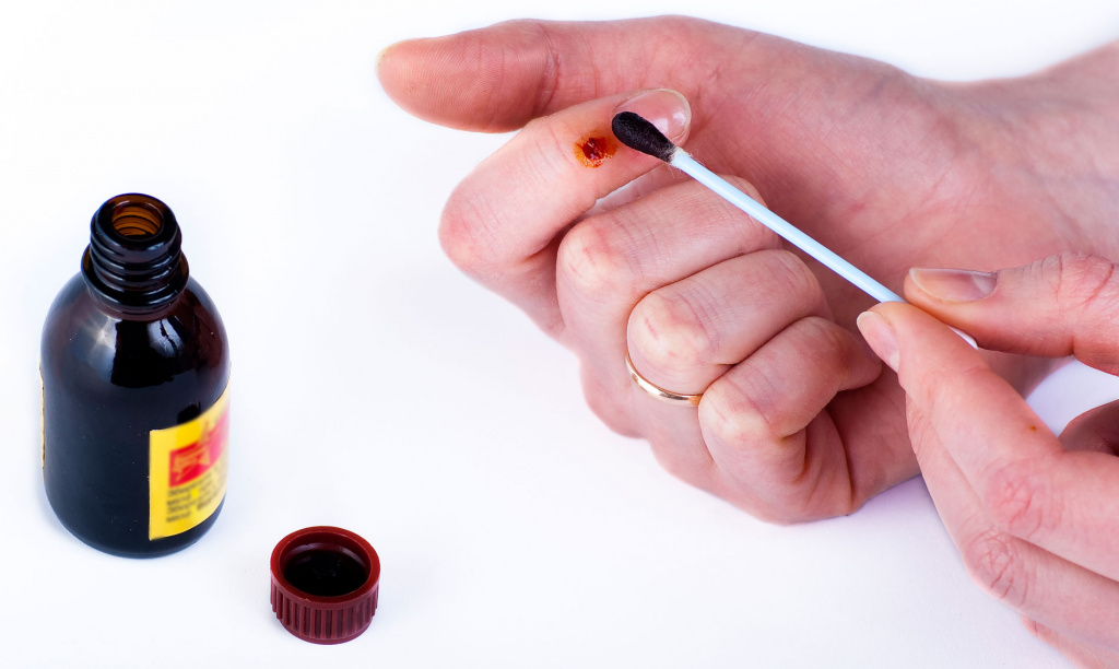 Сегодня спиртосодержащий раствор йода является зарегистрированным лекарственным средством, предназначенным для наружного применения Спиртосодержащий раствор йода