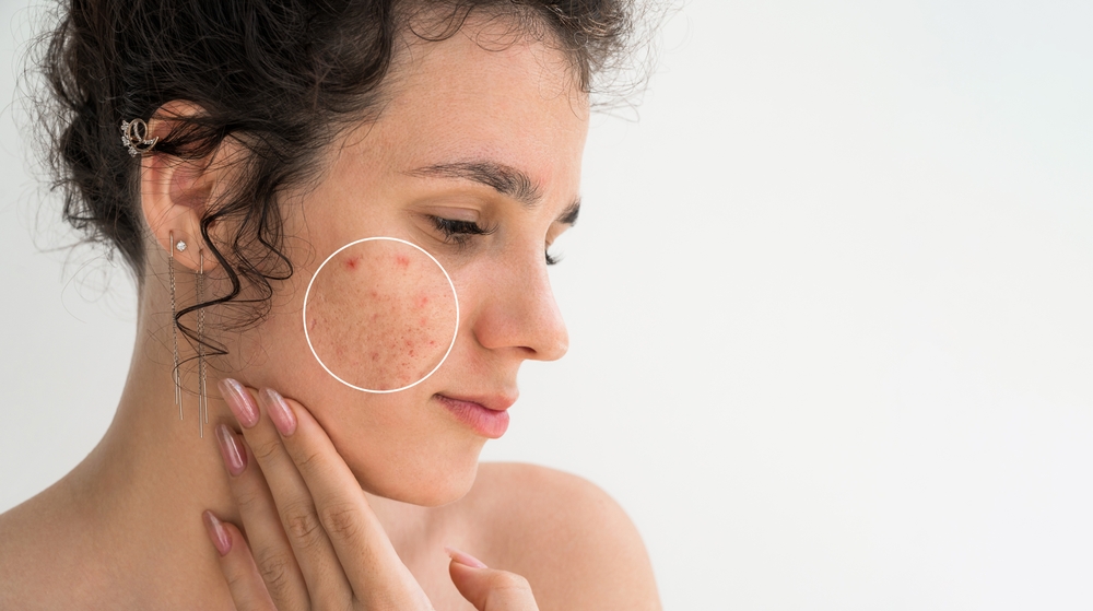 Для начала, важно посетить дерматолога. После осмотра врач оценит возможные причины заболевания и даст направление к более узким специалистам К какому врачу обратиться с проблемой?