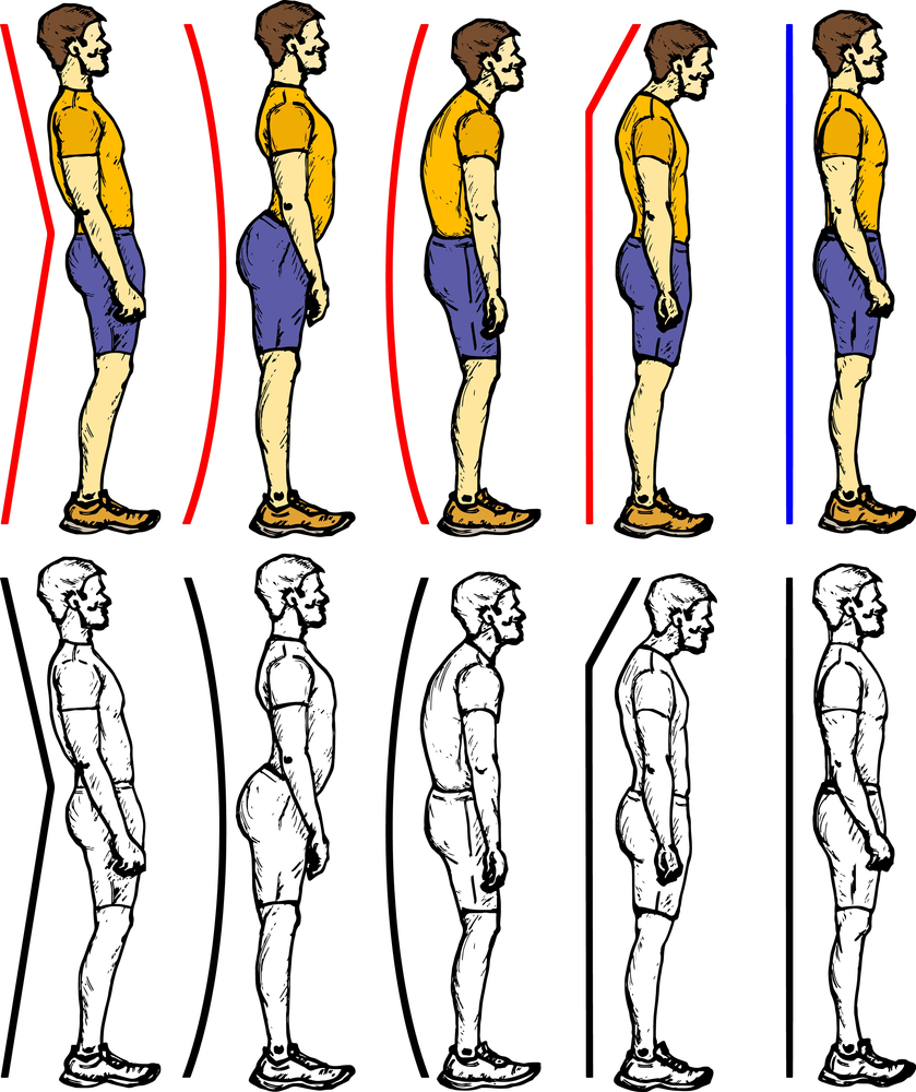 Причины неправильной осанки могут быть разными, начиная от серьезной болезни, заканчивая обычной невнимательностью Причины неправильной осанки
