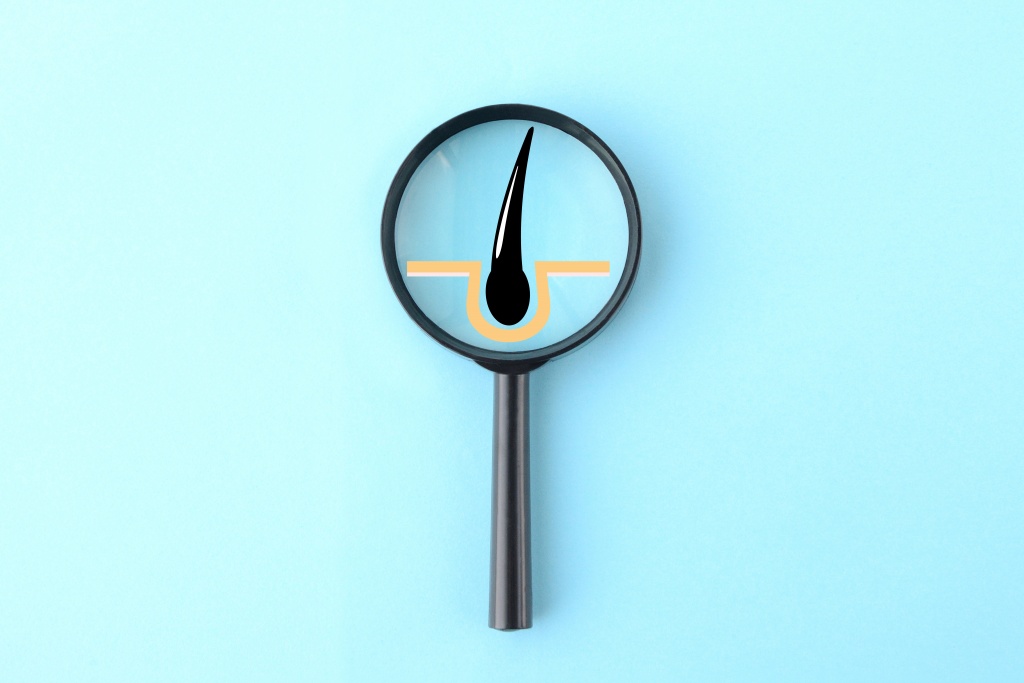 Если беспокоит зуд, ломкость, сухость, выпадение - значит, истощены волосяные луковицы Укрепление корней волос