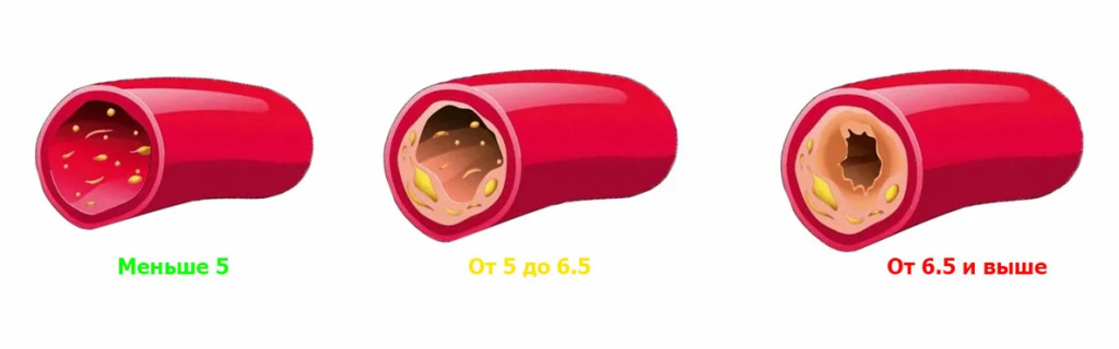 В норме показатели холестерина в крови должны быть в пределах от 2,5 до 3,3 ммоль/л показатели холестерина в крови