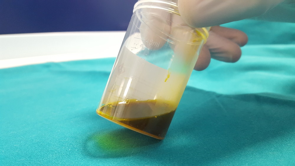 Внешне желчь - это вещество вязкой консистенции с желтоватым оттенком Желчь