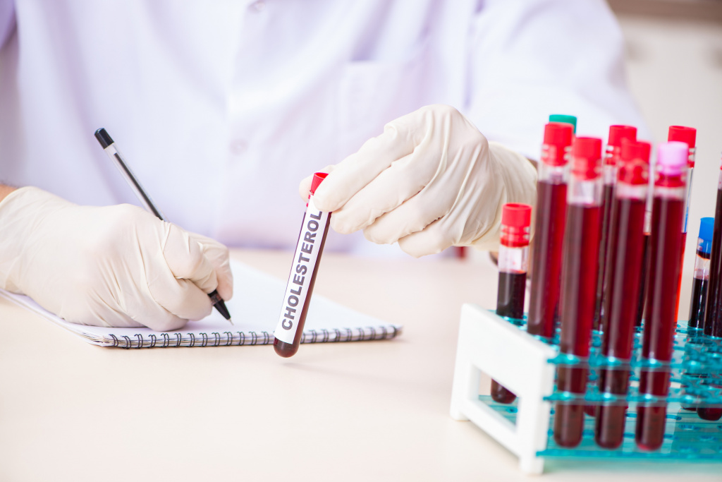 Повышение этого липофильного спирта в крови — убедительный призыв кардинально изменить свой жизненный уклад, перейти на здоровую диету и больше времени уделять физкультуре Что принимать при повышенном холестерине