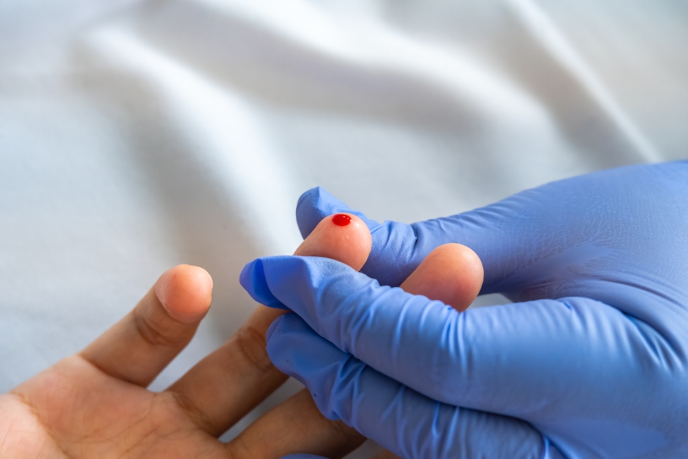 Оптимальная норма сахара в крови составляет 70–110 мг/дл. Более высокие показатели могут сигнализировать о наличии сахарного диабета diabetes-2424105_1920.jpg