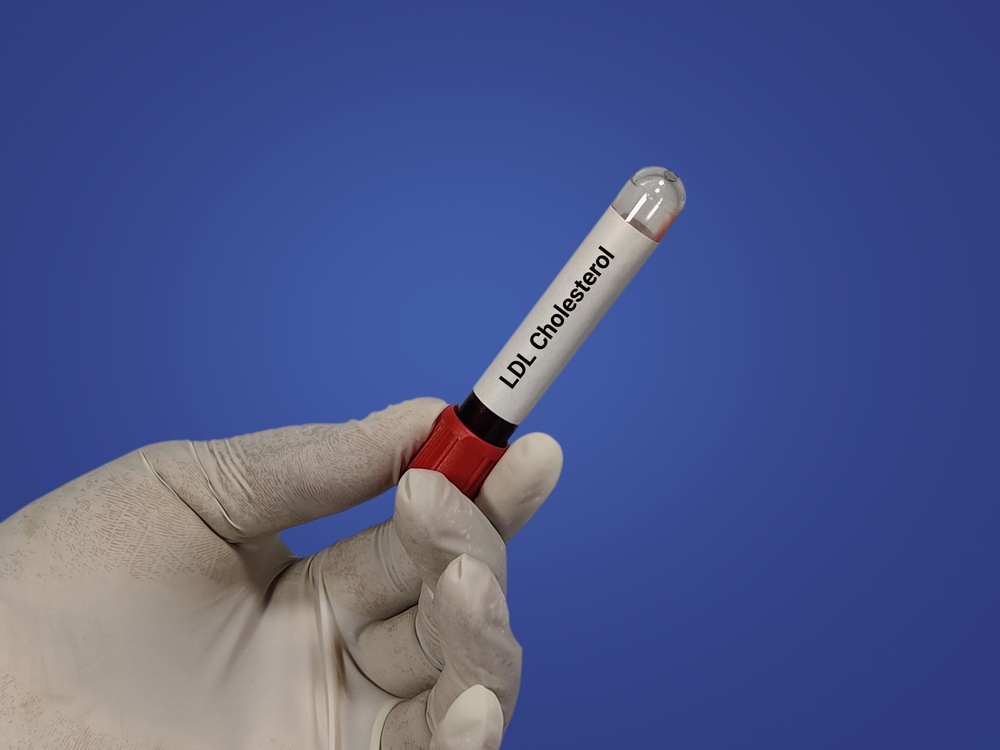 Чтобы показатели были максимально правдивы, необходимо качественно подготовиться к исследованию. Все подробности объясняет лечащий врач Как подготовиться к анализу