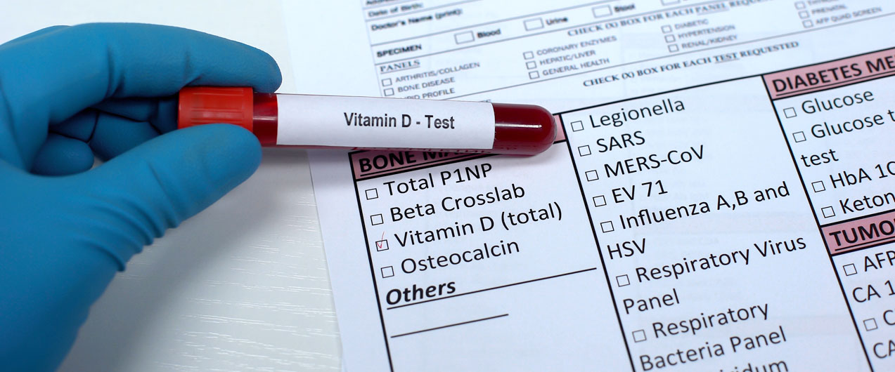 Проверка уровня витамина Д