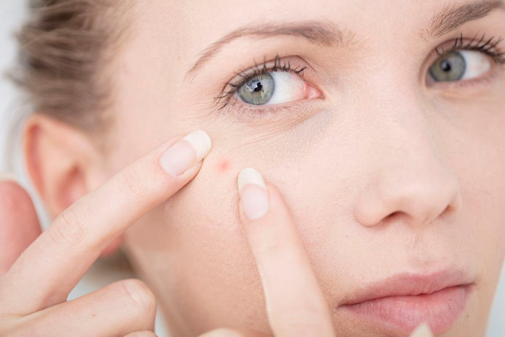 Что делать, чтобы кожа лица была чистой и здоровой?