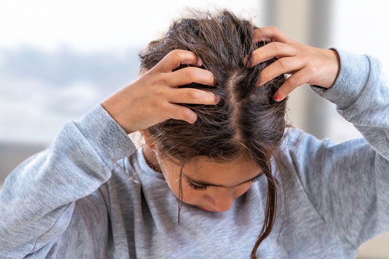 Как устранить причину перхоти у ребенка