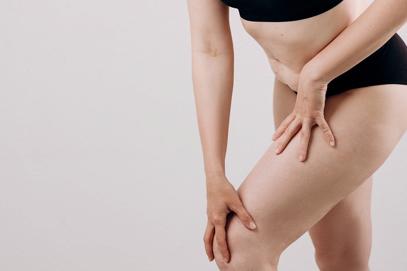 12 способов избавиться от целлюлита