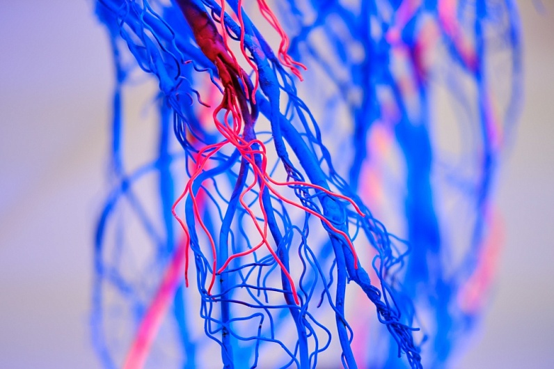 Что полезно для сосудов и как их укрепить 