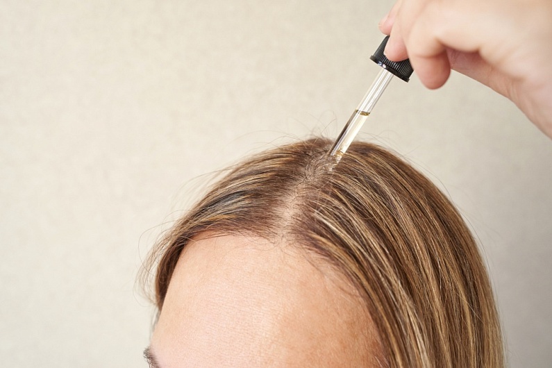 Укрепление волосяных луковиц