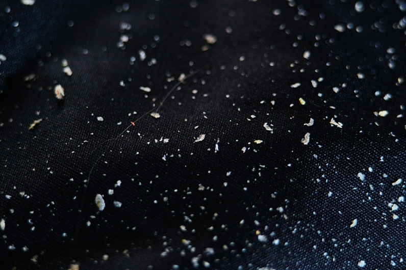 Как избавиться от перхоти хлопьями?