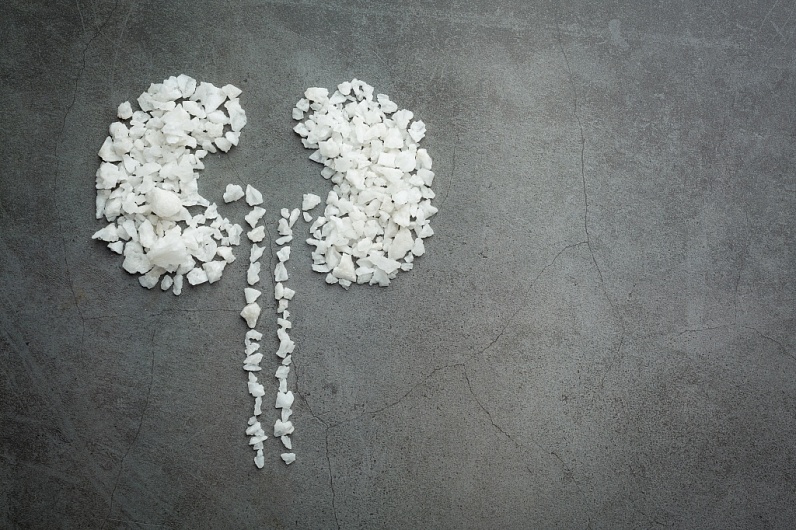 Соль в почках — как вывести