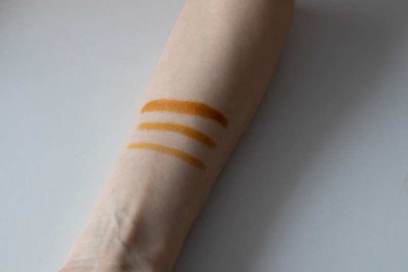 Симптомы аллергии на йод