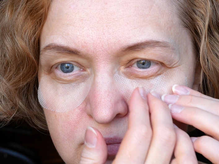 Причины птоза лица и как с ним бороться