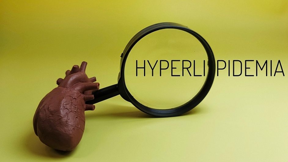 Как правильно сдавать анализ на холестерин?