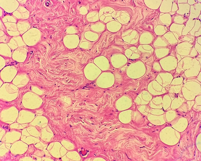 Название жировой клетчатки