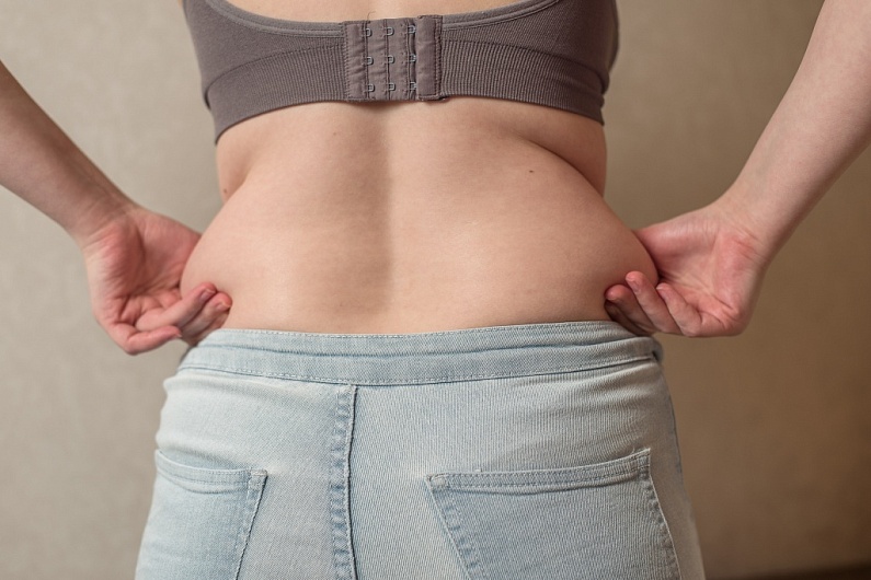 Как избавиться от боков без упражнений